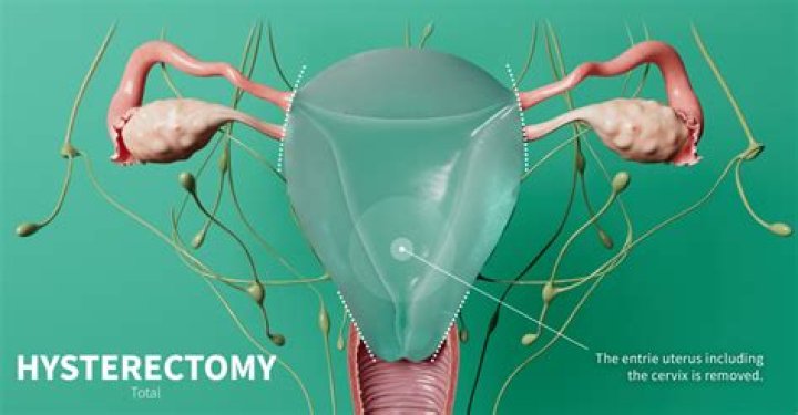 Uncovering Kate's Hysterectomy: Unveiling Medical Mysteries